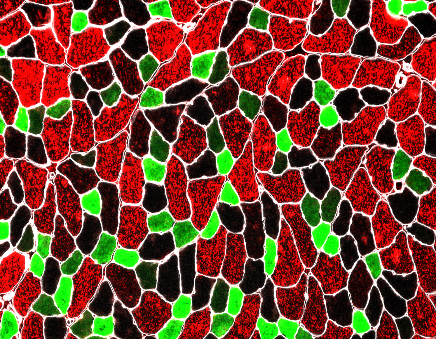 Microscopic view shows red, black, and green cell-like shapes separated ...