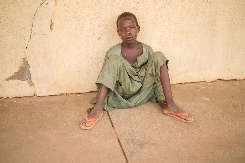 10 year old Maniru has such a severe trachoma infection he needs surgery to save his sight