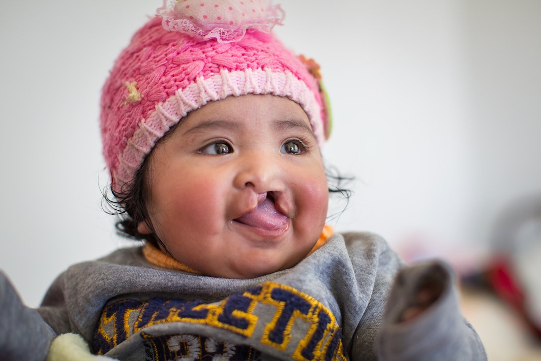 Ashly's parents were overjoyed that their baby was finally getting the surgery she needed.