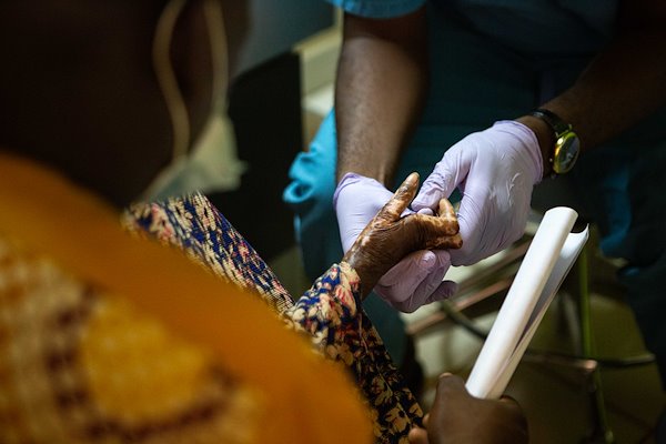 A consultation for a girl with a burned hand.