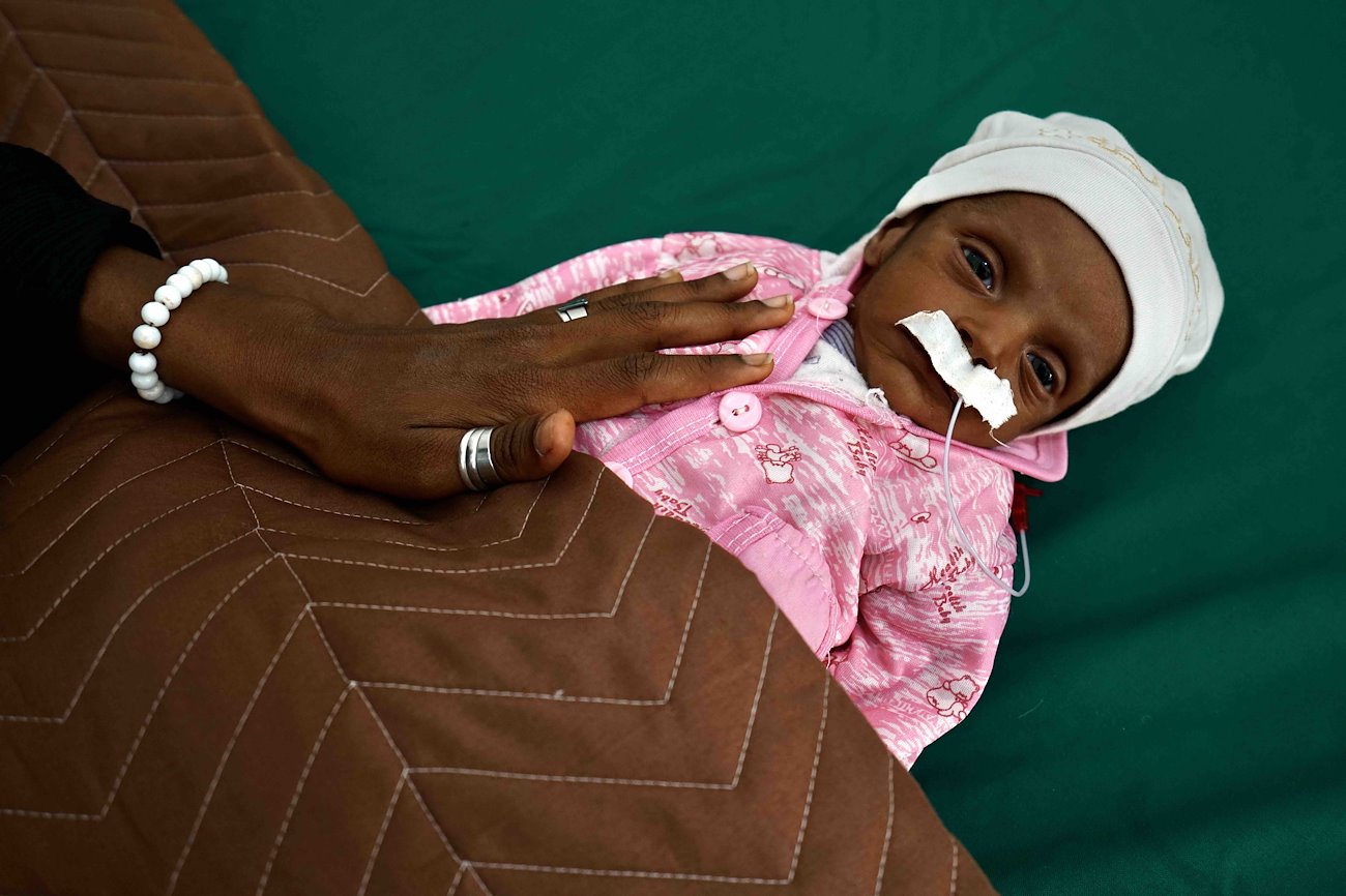 Tahani is just 38 days old and suffers from severe acute malnutrition. Her mother brought her to Al Sadaqah hospital due to her frequent diarrhoea and sudden weight loss.  ©UNOCHA/Giles Clarke