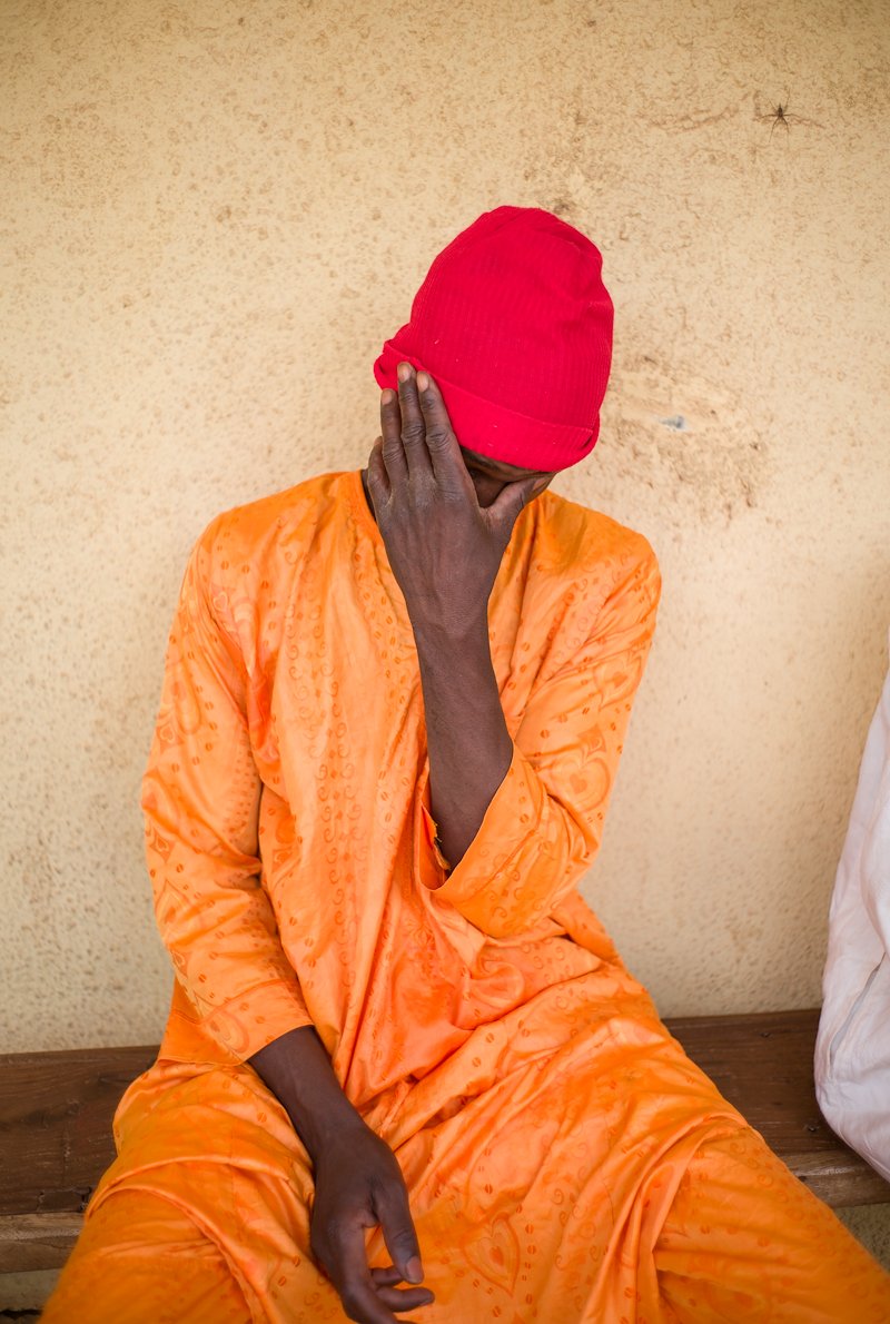 Trachoma patient Bello shields his eyes from the harsh sun as he waits for sight saving surgery