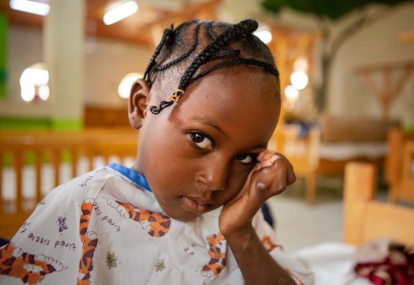 Kadidja's waited years for surgery, and she is finally here!