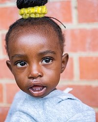 Firdaus is looking beautiful and her lip has healed nicely!