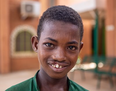 Garba's lived with a cleft-lip for fifteen years, and he is anxious for surgery.