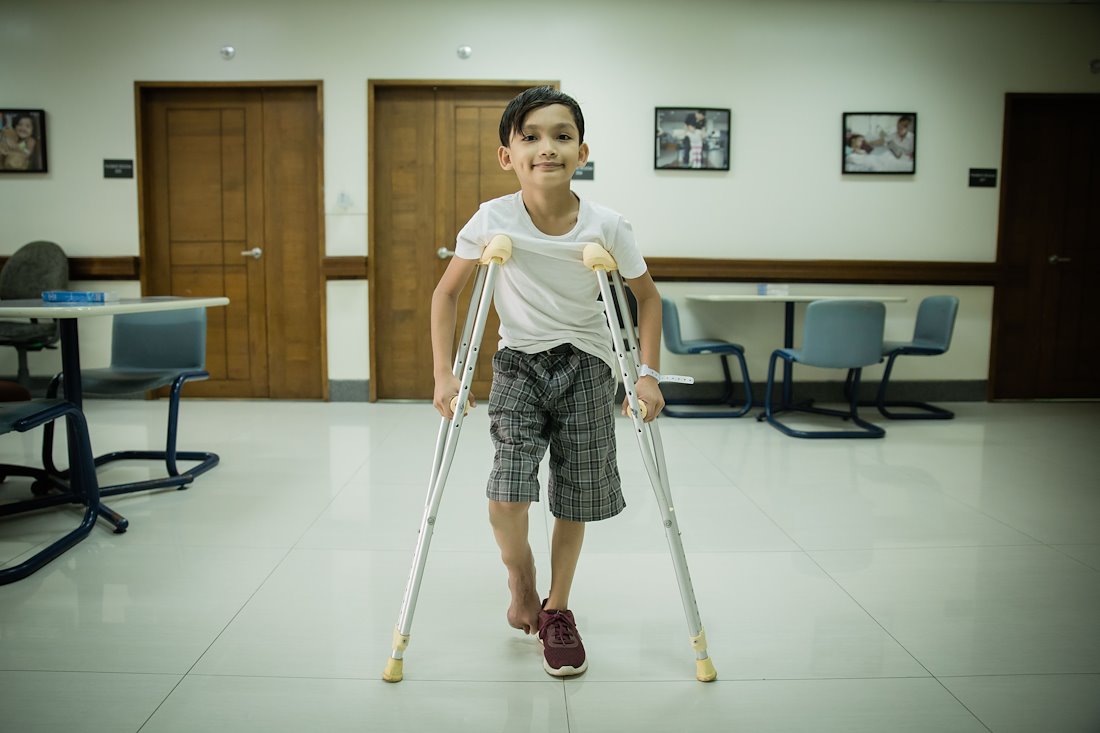 Wilson told us,"I will get a prosthetic leg very soon. Then, I'll become like Iron Man!"