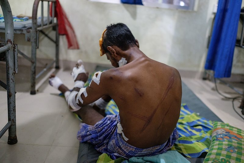 Rohingya patient in MSF MSF's medical facility, Kutupalong Refugee Camp Cox's Bazar. Sept 18, 2017 ©Antonio Faccilongo