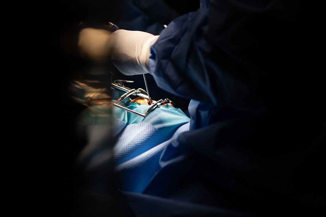 Starting a cleft-palate surgery