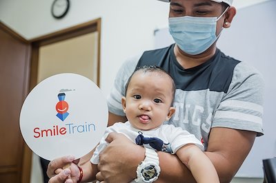 Kobe's cleft lip is healed! Thanks to our partners from Smile Train!