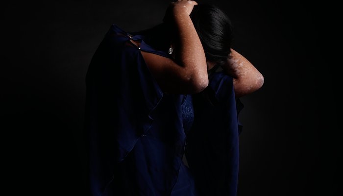 Read Life, Loss and acceptance by The World of Priyam