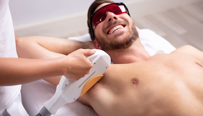 Read Why Do Experts Say Laser Hair Removal Is the Future? by Peter Astle