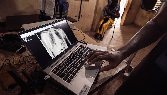 Read Innovation, Zugang und Wirkung: Beschleunigung der Anstrengungen zur Beendigung der Tuberkulose by The Global Fund